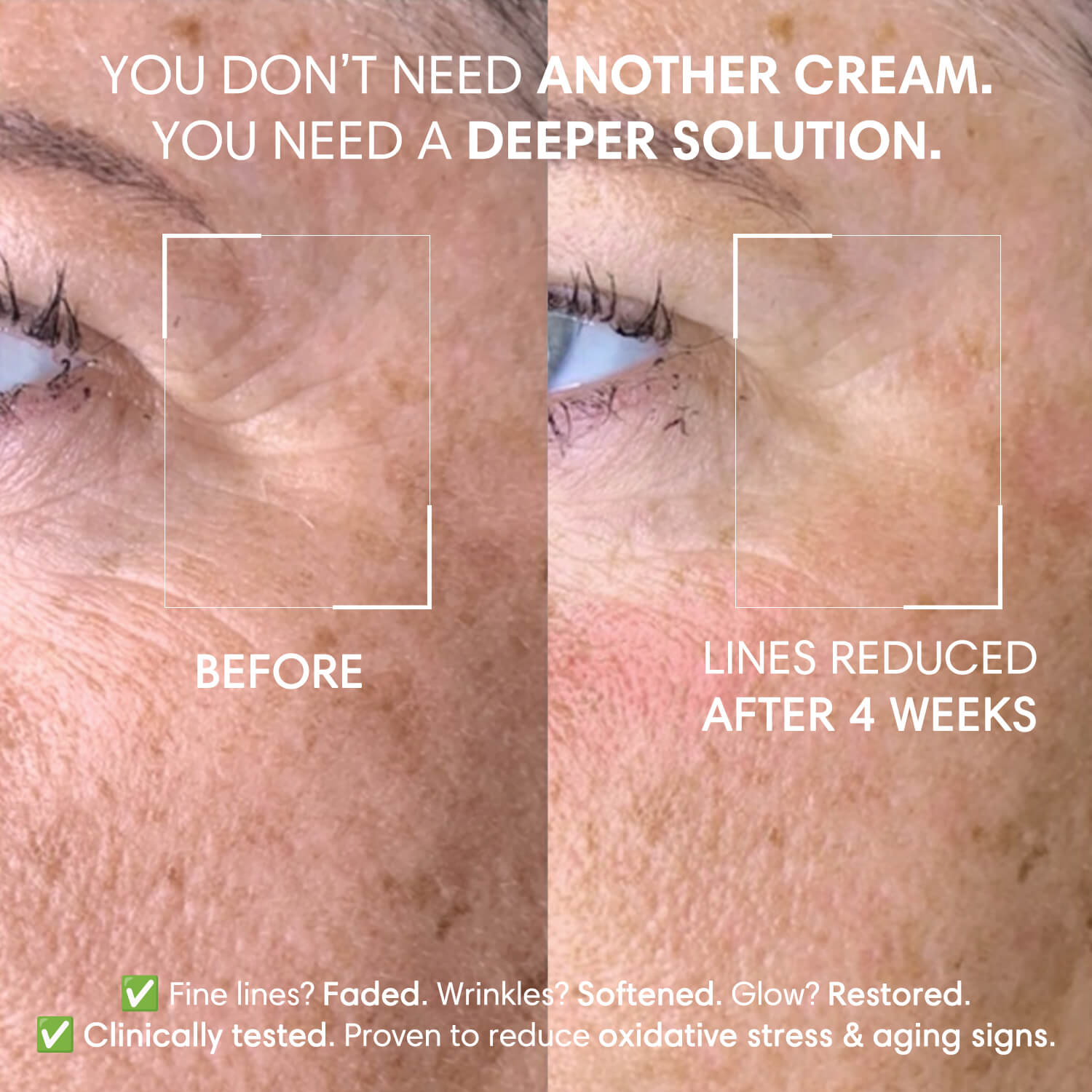 Skip the Filters: Embrace a New Level of Confidence with Skindro