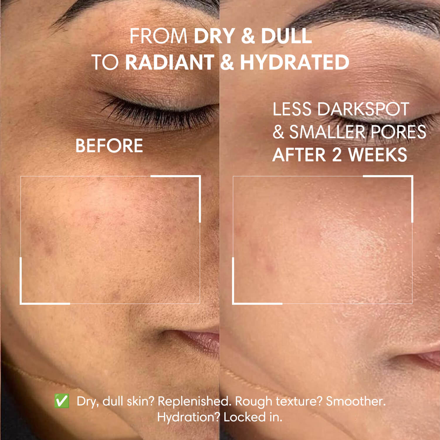 Skip the Filters: Embrace a New Level of Confidence with Skindro