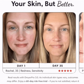 Skip the Filters: Embrace a New Level of Confidence with Skindro