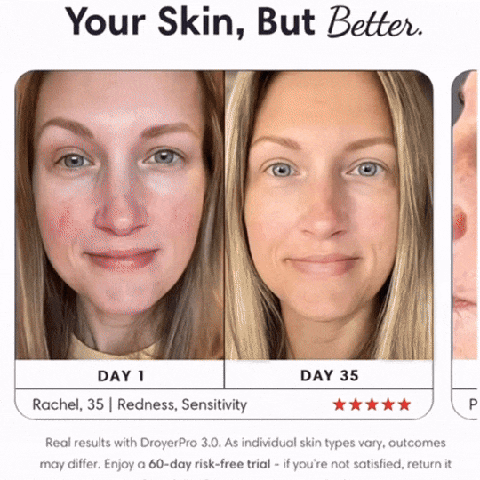 Skip the Filters: Embrace a New Level of Confidence with Skindro